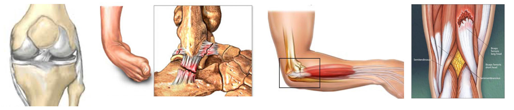 PRP Injections can be used for joints, ligaments, tendons and muscles.